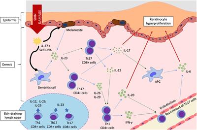 Combining Understanding of Immunological Mechanisms and Genetic Variants Toward Development of Personalized Medicine for Psoriasis Patients